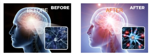 NTX NeuroElite Before and After